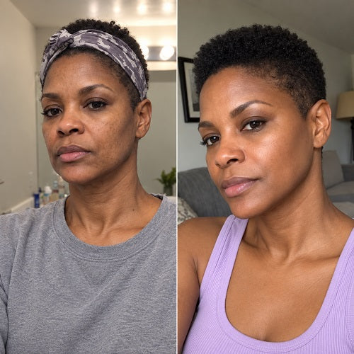 Before and after