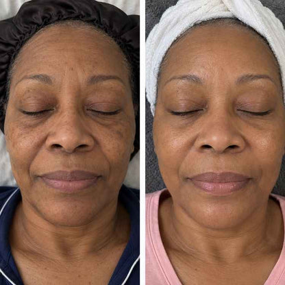 LeadingWish® Collagen Peptide